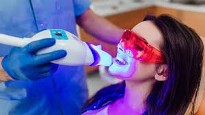 Clareamento Dental Profissional